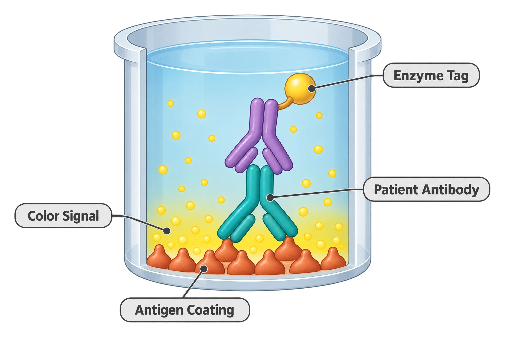Cross-section of a single ELISA test well showing antigen fixed to the bottom, a patient antibody bound to the antigen, and an enzyme-tagged secondary antibody producing a color signal.